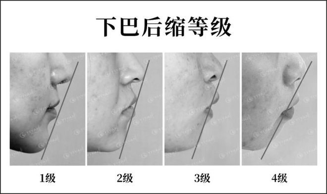 21點：很難說這個bug和頭禿哪個更致命